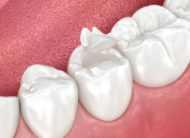 Best Dental Studio in Holly, MI