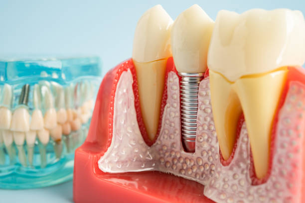 Best Preventive Dentistry  in Holly, MI